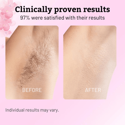 ✨  Cyperus Rotundus Oil for Natural Permanent Hair Reduction